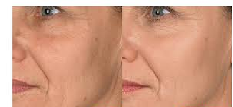 Anti-Aging Hakkında Bilmeniz Gereken 6 Şey